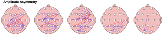عدم تقارن (Asymmetry)