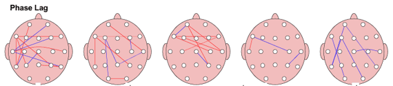 تأخیر فاز (Phase Lag)