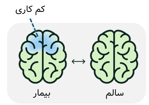 مقایسه با الگوی نرمال
